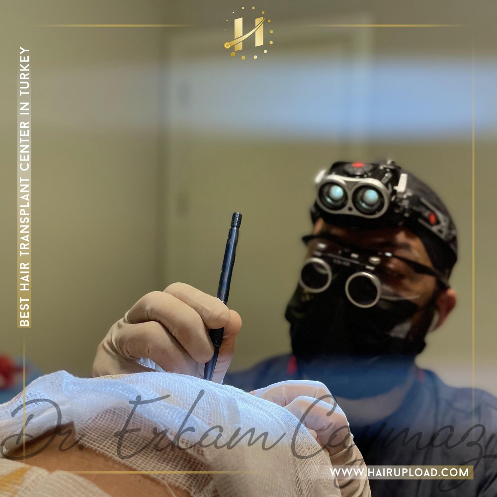 Dr. Erkam Caymaz – Hair Transplant Surgeon Istanbul