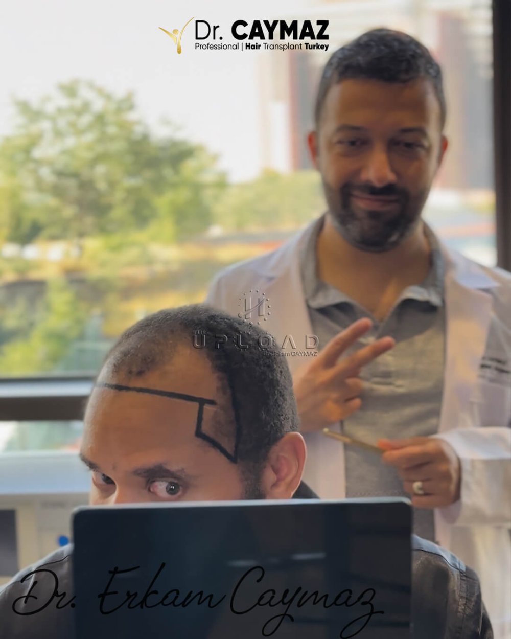 Happy Patients Dr Erkam Caymaz 14