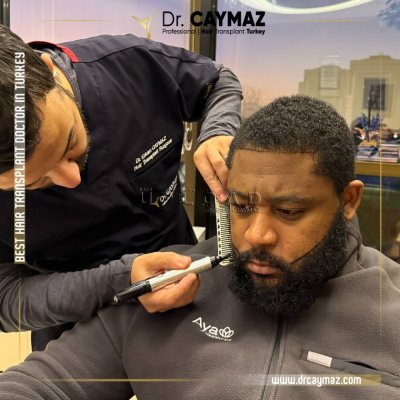 Komplikationen bei Haartransplantationen und wie man damit umgeht: ein umfassender Leitfaden