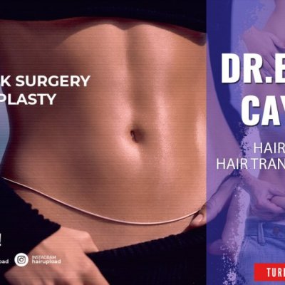 tummy tuck surgery | abdominoplasty