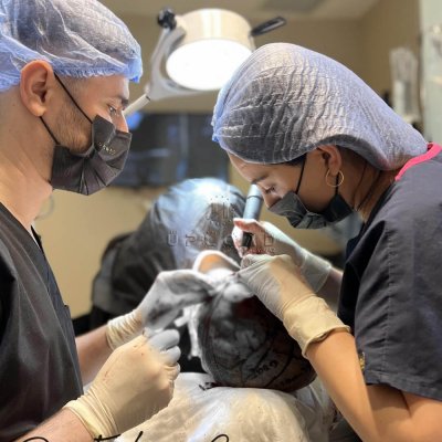 Was bedeutet Überernte: Haartransplantation?