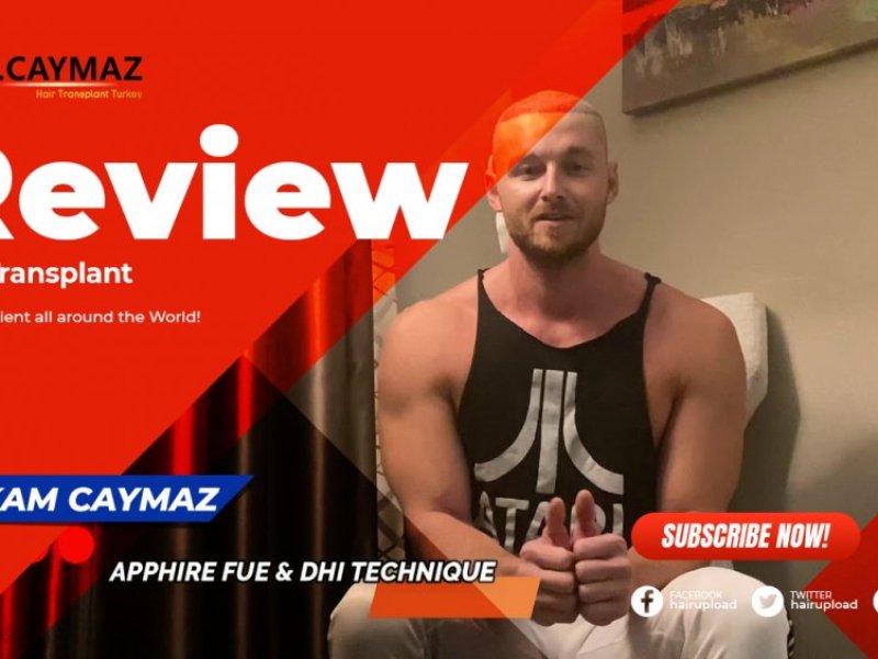 Hair Transplant Turkey Reviews