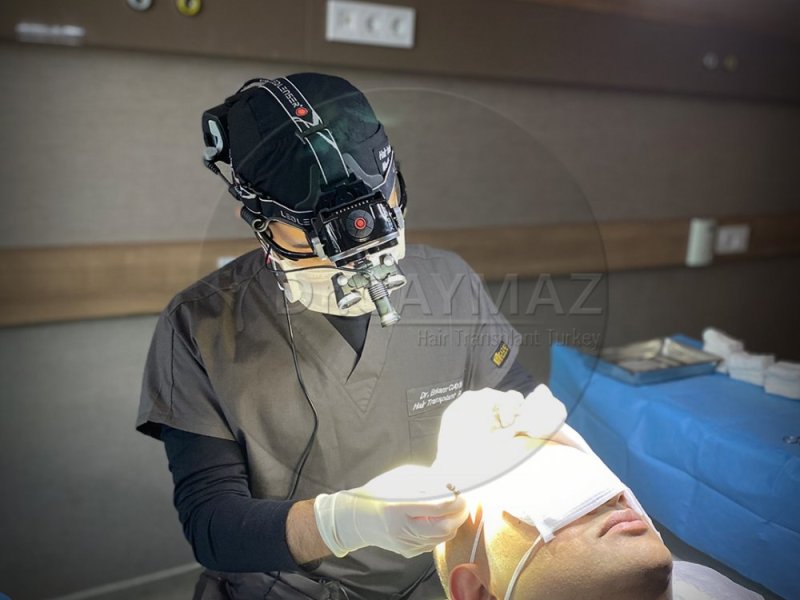 Hair Transplant Turkey
