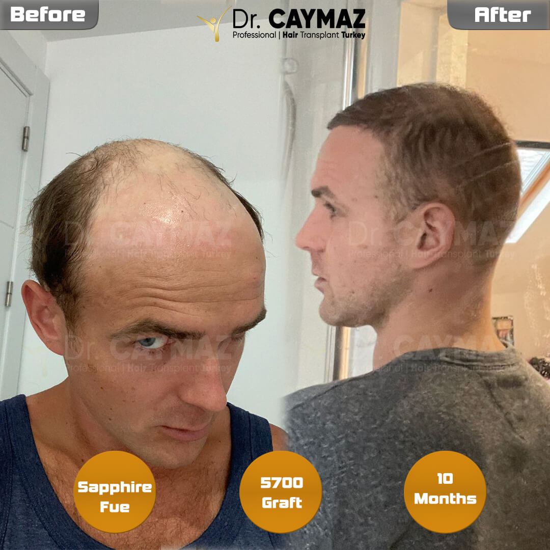 10 Months Norwood 7 Result