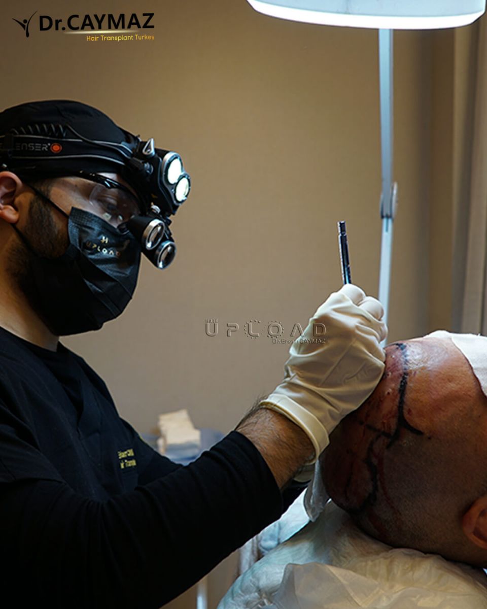 Dr Erkam Caymaz Hair Upload Clinic In Turkey Sapphire