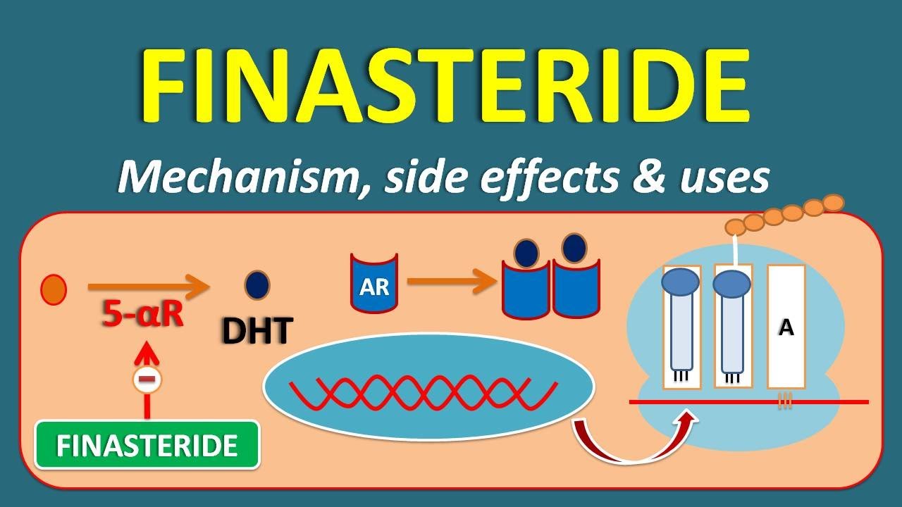 Finasteride